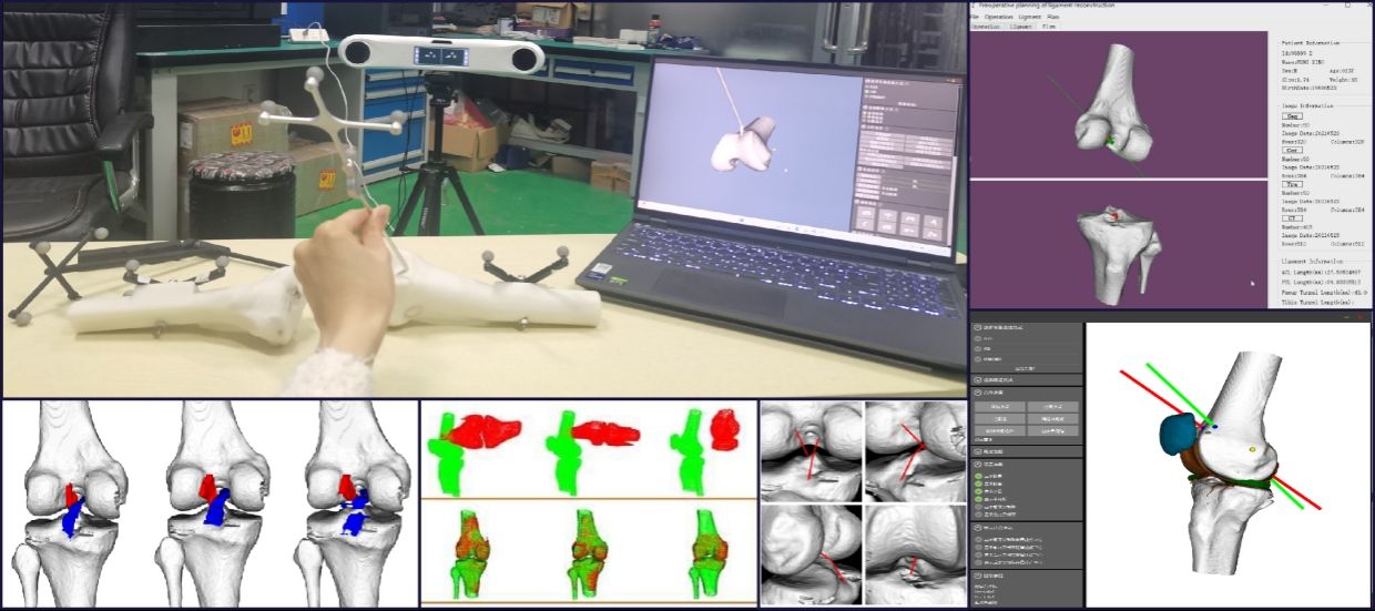 【学在大工】我校学生团队荣获第十七届iCAN全国总决赛一等奖